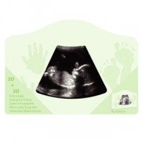 Sonogram Frame Sonogram Frame